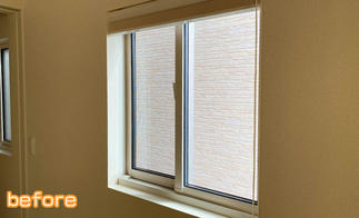 インプラス施工前