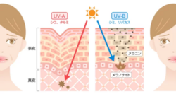 UV.png